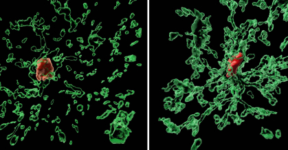 Green spatterings on black background represent images of microglia brain immune cells
