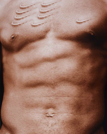 "Scarred Chest" is a 2003 digital chromogenic print by Hank Willis Thomas.